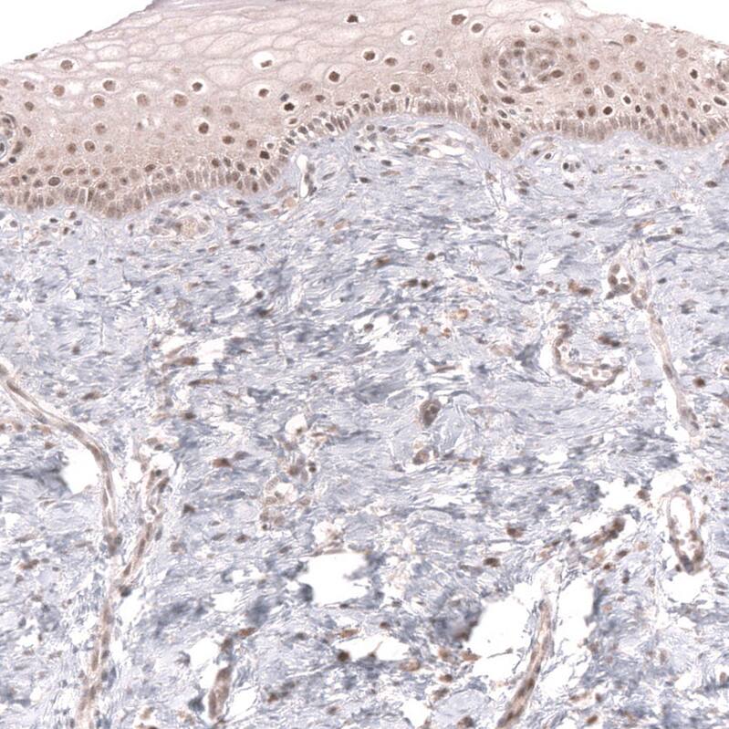 MSH3 Antibody (CL14059) - Azide and BSA Free Immunohistochemistry-Paraffin: MSH3 Antibody [NBP3-43855]