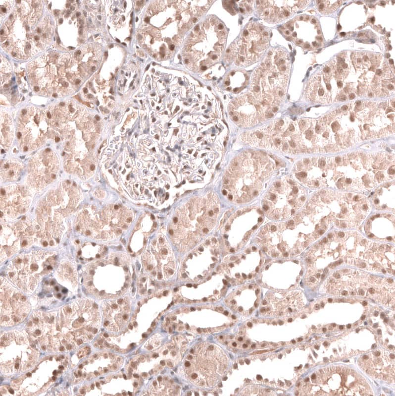 MSH3 Antibody (CL14059) - Azide and BSA Free Immunohistochemistry-Paraffin: MSH3 Antibody [NBP3-43855]