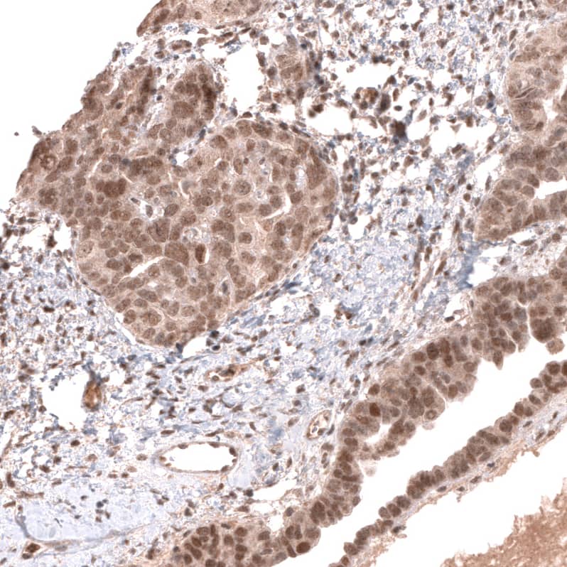 MSH3 Antibody (CL14059) - Azide and BSA Free Immunohistochemistry-Paraffin: MSH3 Antibody [NBP3-43855]