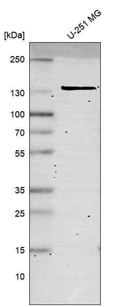 MSH3 Antibody (CL14059) - Azide and BSA Free Western Blot: MSH3 Antibody [NBP3-43855]