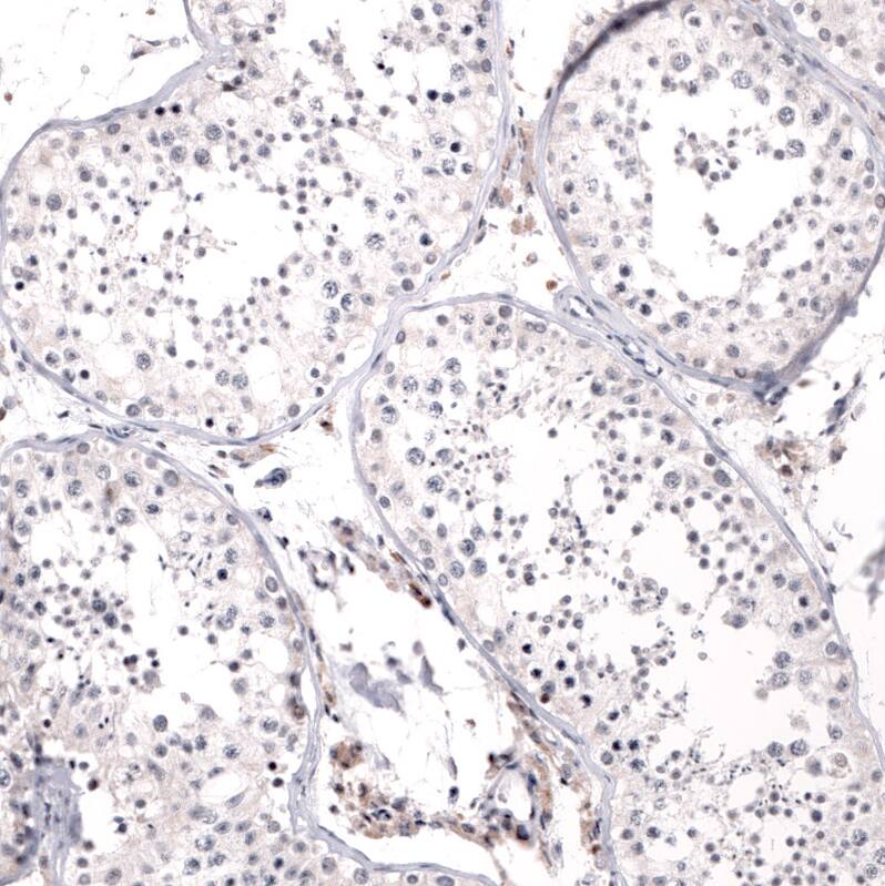 MSH3 Antibody (CL14059) - Azide and BSA Free Immunohistochemistry-Paraffin: MSH3 Antibody [NBP3-43855]