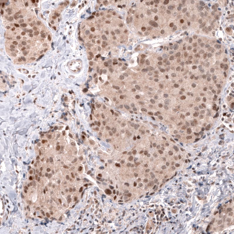 MSH3 Antibody (CL14064) - Azide and BSA Free Immunohistochemistry-Paraffin: MSH3 Antibody [NBP3-43856]