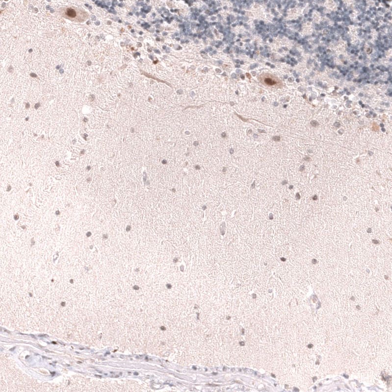 MSH3 Antibody (CL14064) - Azide and BSA Free Immunohistochemistry-Paraffin: MSH3 Antibody [NBP3-43856]
