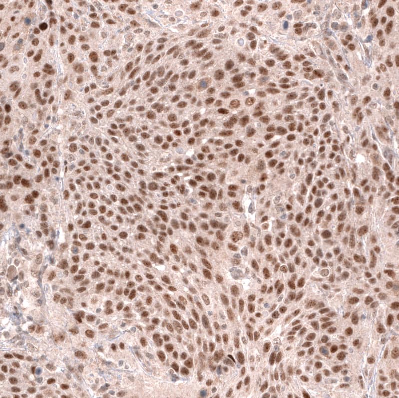 MSH3 Antibody (CL14064) - Azide and BSA Free Immunohistochemistry-Paraffin: MSH3 Antibody [NBP3-43856]