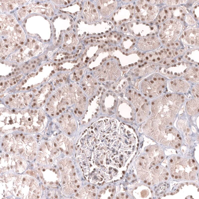 MSH3 Antibody (CL14064) - Azide and BSA Free Immunohistochemistry-Paraffin: MSH3 Antibody [NBP3-43856]