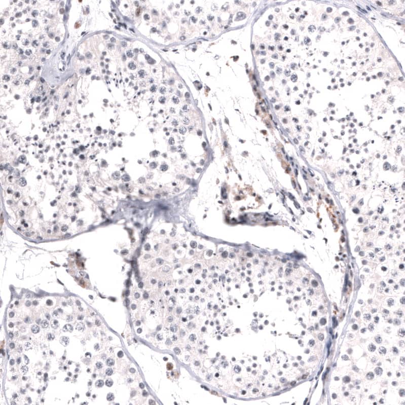 MSH3 Antibody (CL14064) - Azide and BSA Free Immunohistochemistry-Paraffin: MSH3 Antibody [NBP3-43856]