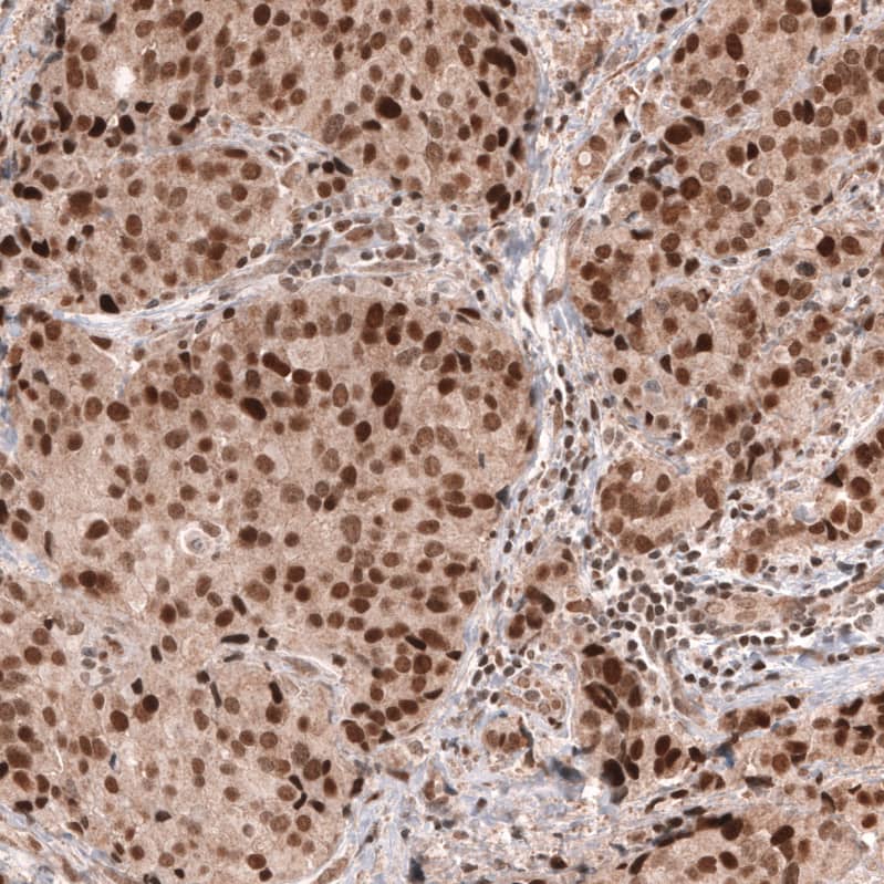 MSH6 Antibody (CL13844) - Azide and BSA Free Immunohistochemistry-Paraffin: MSH6 Antibody [NBP3-43857]