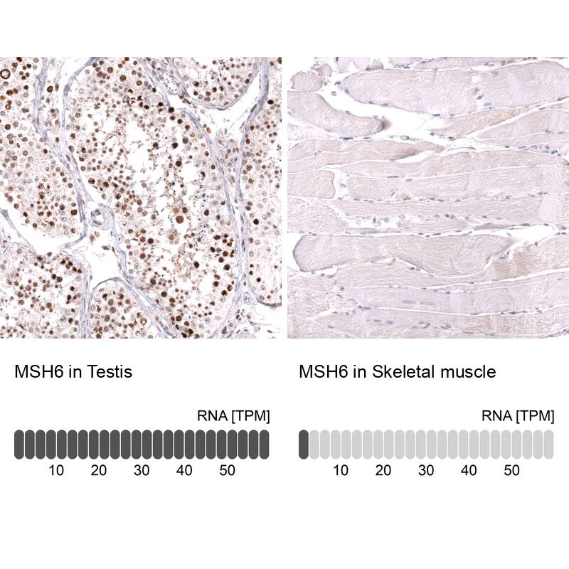 MSH6 Antibody (CL13844) - Azide and BSA Free Immunohistochemistry-Paraffin: MSH6 Antibody [NBP3-43857]