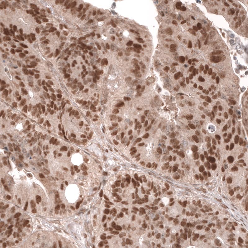 MSH6 Antibody (CL13844) - Azide and BSA Free Immunohistochemistry-Paraffin: MSH6 Antibody [NBP3-43857]