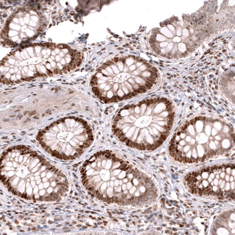 MSH6 Antibody (CL13844) - Azide and BSA Free Immunohistochemistry-Paraffin: MSH6 Antibody [NBP3-43857]