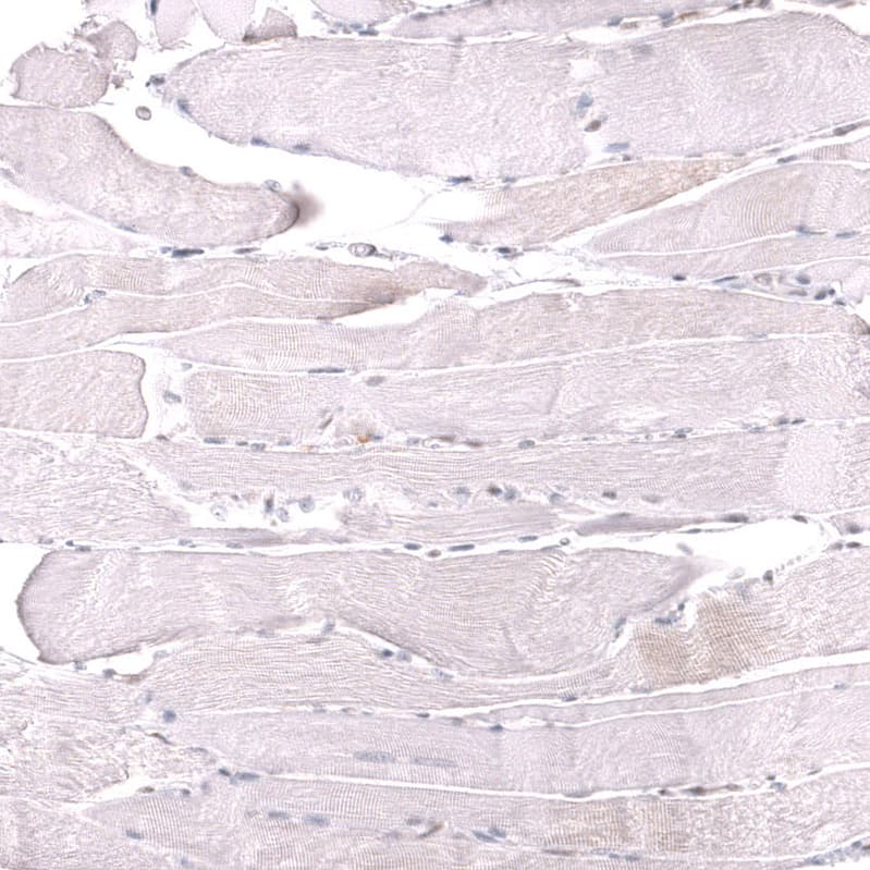 MSH6 Antibody (CL13844) - Azide and BSA Free Immunohistochemistry-Paraffin: MSH6 Antibody [NBP3-43857]