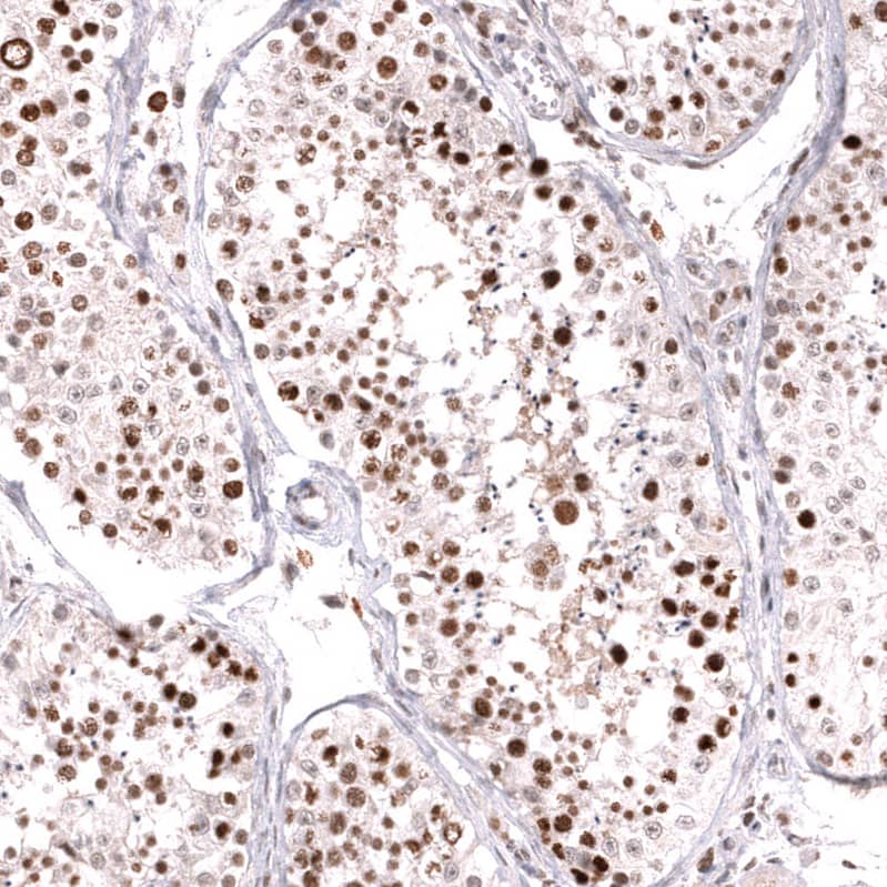 MSH6 Antibody (CL13844) - Azide and BSA Free Immunohistochemistry-Paraffin: MSH6 Antibody [NBP3-43857]