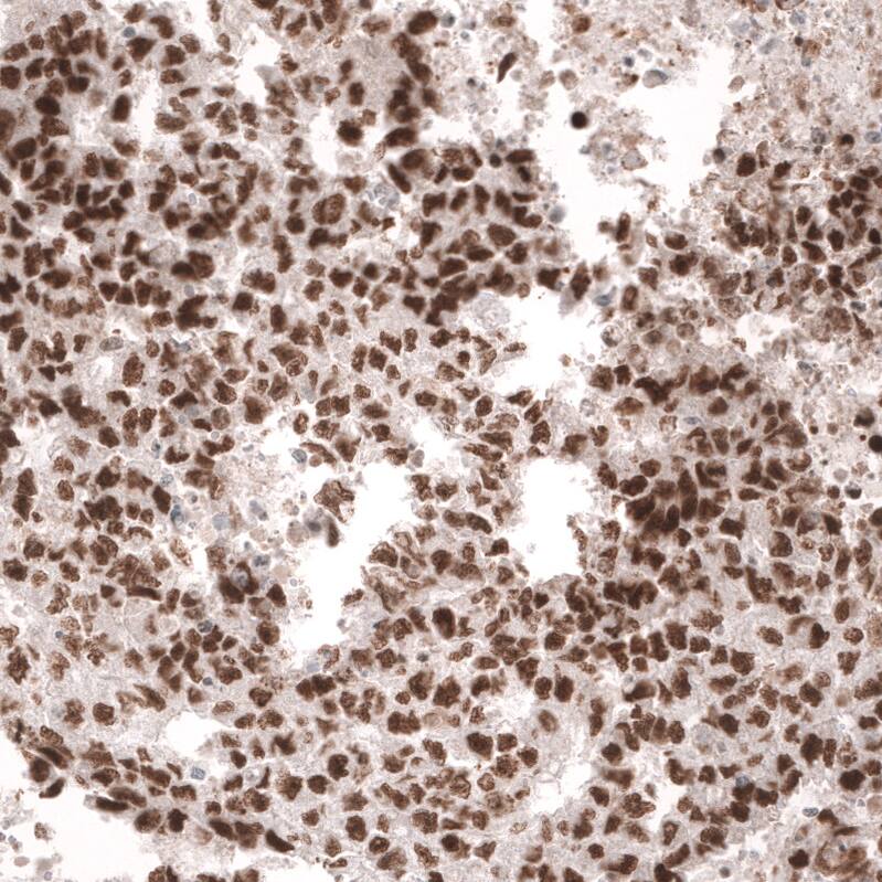 MSH6 Antibody (CL13844) - Azide and BSA Free Immunohistochemistry-Paraffin: MSH6 Antibody [NBP3-43857]