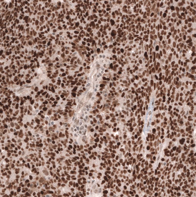 MSH6 Antibody (CL13844) - Azide and BSA Free Immunohistochemistry-Paraffin: MSH6 Antibody [NBP3-43857]