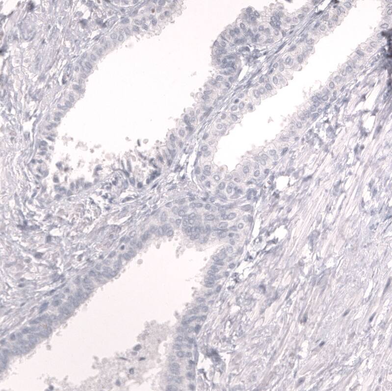 Prox1 Antibody (CL13472) - Azide and BSA Free Immunohistochemistry-Paraffin: Prox1 Antibody [NBP3-43858]