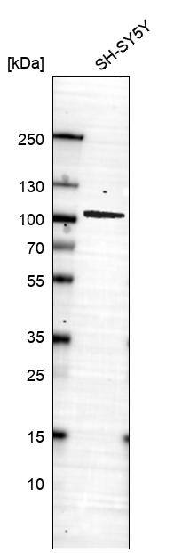 Prox1 Antibody (CL13472) - Azide and BSA Free Western Blot: Prox1 Antibody [NBP3-43858]