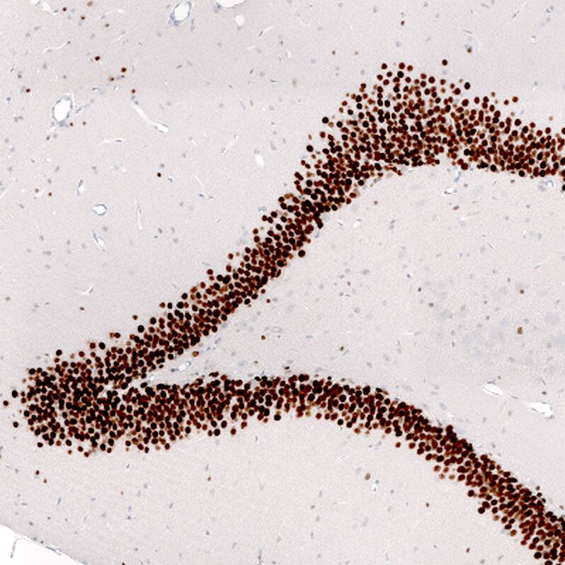 Prox1 Antibody (CL13472) - Azide and BSA Free Immunohistochemistry-Paraffin: Prox1 Antibody [NBP3-43858]