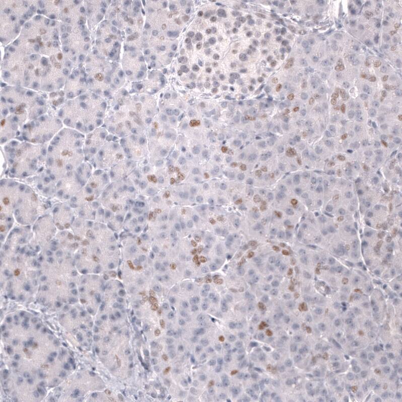 Prox1 Antibody (CL13472) - Azide and BSA Free Immunohistochemistry-Paraffin: Prox1 Antibody [NBP3-43858]