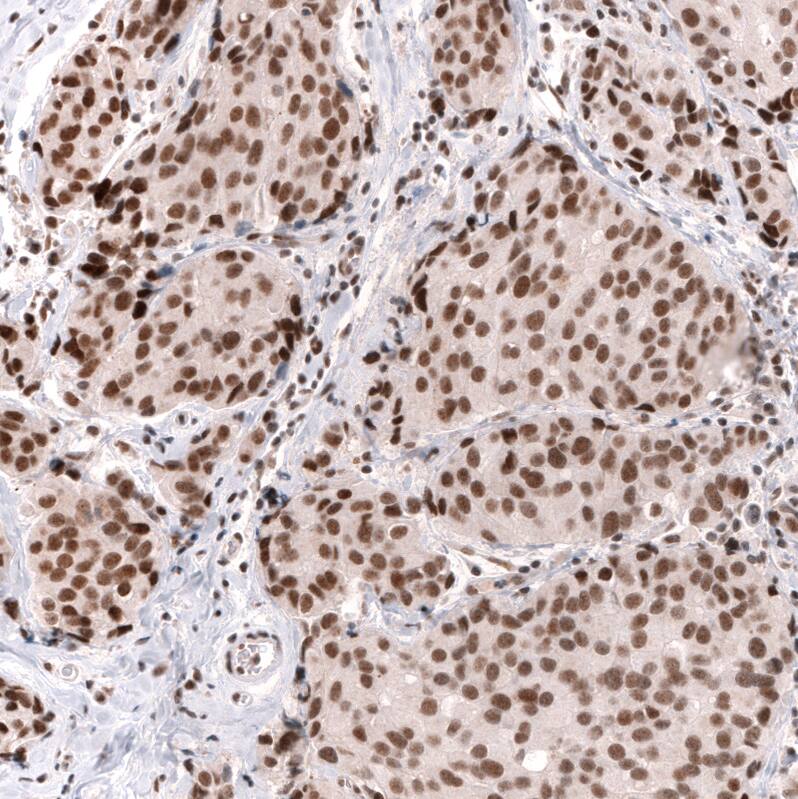 SNF5 Antibody (CL13973) - Azide and BSA Free Immunohistochemistry-Paraffin: SNF5 Antibody [NBP3-43860]