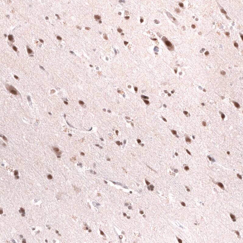 SNF5 Antibody (CL13973) - Azide and BSA Free Immunohistochemistry-Paraffin: SNF5 Antibody [NBP3-43860]