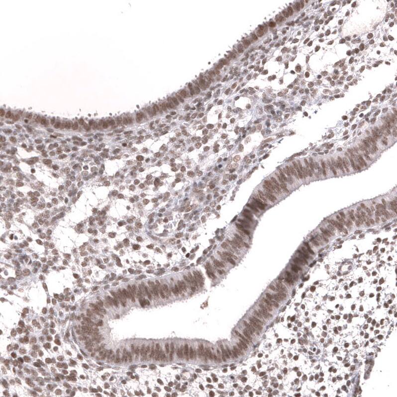 SNF5 Antibody (CL13973) - Azide and BSA Free Immunohistochemistry-Paraffin: SNF5 Antibody [NBP3-43860]