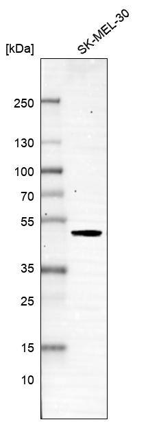 SNF5 Antibody (CL13973) - Azide and BSA Free Western Blot: SNF5 Antibody [NBP3-43860]
