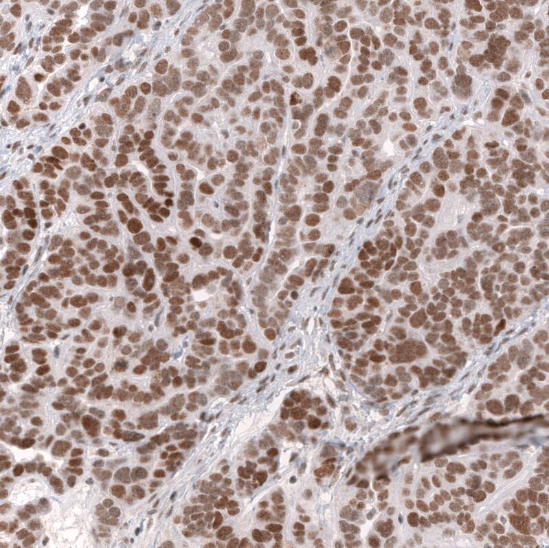 SNF5 Antibody (CL13973) - Azide and BSA Free Immunohistochemistry-Paraffin: SNF5 Antibody [NBP3-43860]