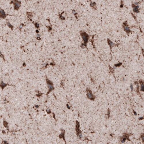 LAMP-1/CD107a Antibody (CL3482) - Azide and BSA Free Immunohistochemistry-Paraffin: LAMP-1/CD107a Antibody [NBP3-43861]