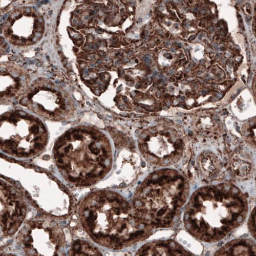 LAMP-1/CD107a Antibody (CL3482) - Azide and BSA Free Immunohistochemistry-Paraffin: LAMP-1/CD107a Antibody [NBP3-43861]