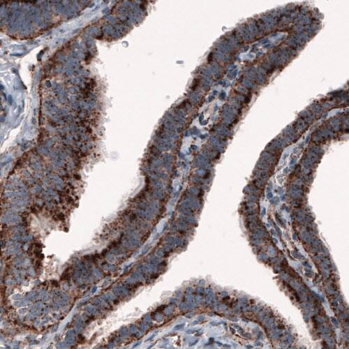 LAMP-1/CD107a Antibody (CL3482) - Azide and BSA Free Immunohistochemistry-Paraffin: LAMP-1/CD107a Antibody [NBP3-43861]
