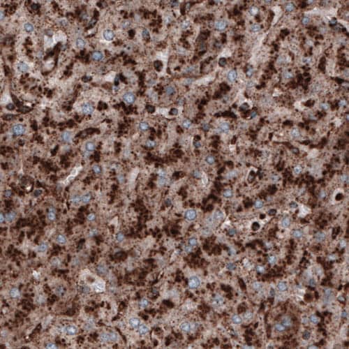LAMP-1/CD107a Antibody (CL3482) - Azide and BSA Free Immunohistochemistry-Paraffin: LAMP-1/CD107a Antibody [NBP3-43861]