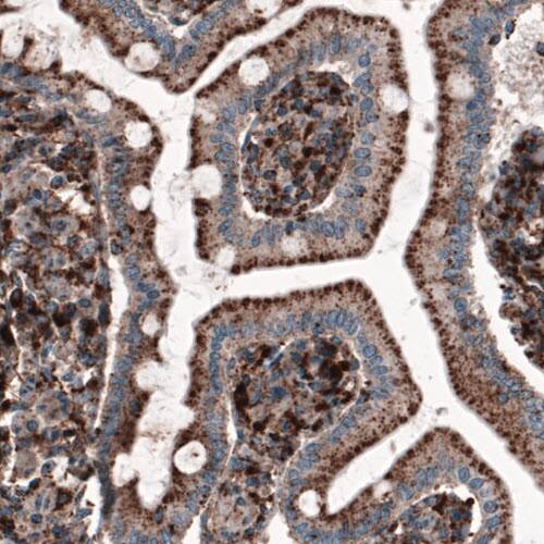 LAMP-1/CD107a Antibody (CL3482) - Azide and BSA Free Immunohistochemistry-Paraffin: LAMP-1/CD107a Antibody [NBP3-43861]
