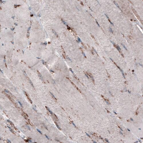 LAMP-1/CD107a Antibody (CL3482) - Azide and BSA Free Immunohistochemistry-Paraffin: LAMP-1/CD107a Antibody [NBP3-43861]