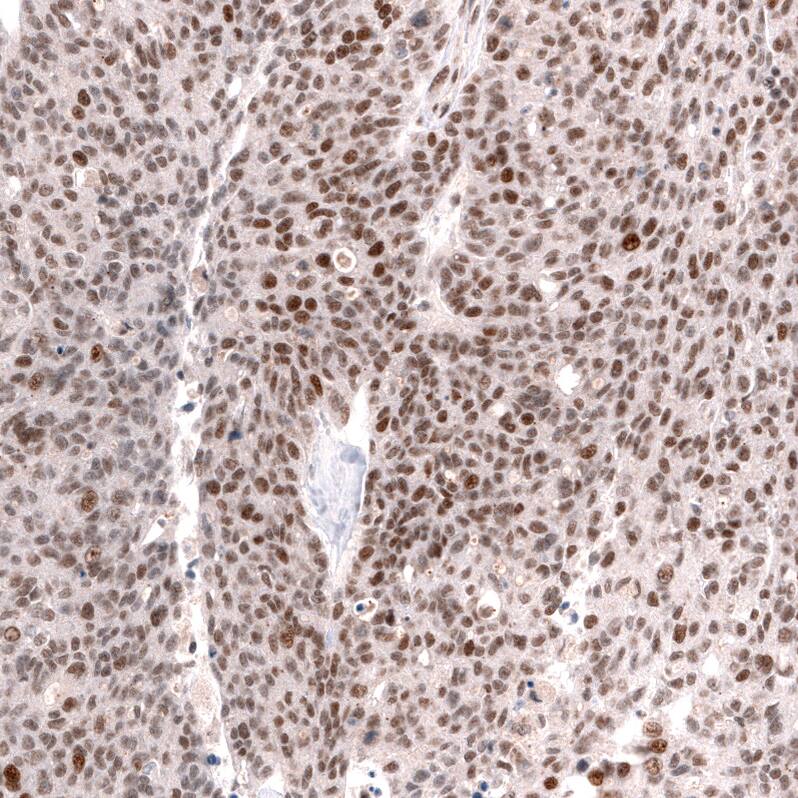 SNF5 Antibody (CL13992) - Azide and BSA Free Immunohistochemistry-Paraffin: SNF5 Antibody [NBP3-43862]