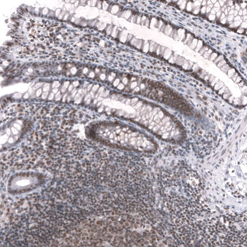 SNF5 Antibody (CL13992) - Azide and BSA Free Immunohistochemistry-Paraffin: SNF5 Antibody [NBP3-43862]