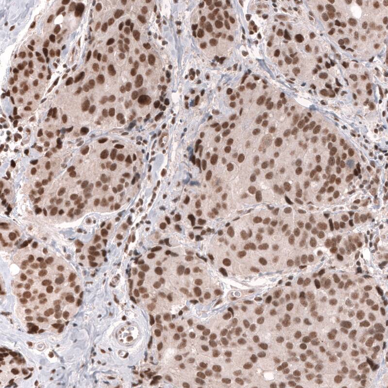 SNF5 Antibody (CL14017) - Azide and BSA Free Immunohistochemistry-Paraffin: SNF5 Antibody [NBP3-43863]