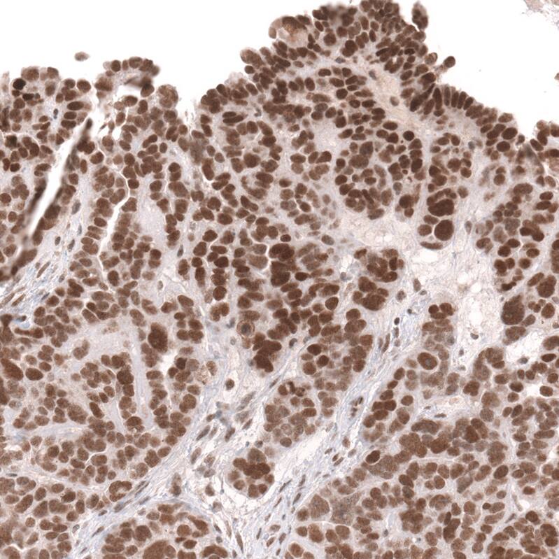 SNF5 Antibody (CL14017) - Azide and BSA Free Immunohistochemistry-Paraffin: SNF5 Antibody [NBP3-43863]