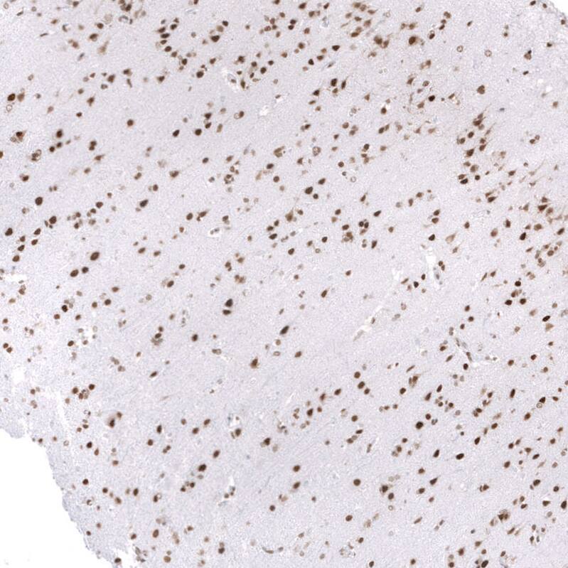 SNF5 Antibody (CL14031) - Azide and BSA Free Immunohistochemistry-Paraffin: SNF5 Antibody [NBP3-43864]