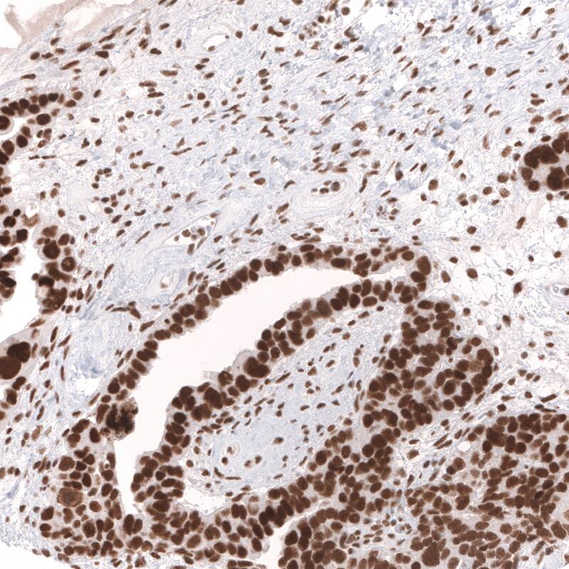SNF5 Antibody (CL14031) - Azide and BSA Free Immunohistochemistry-Paraffin: SNF5 Antibody [NBP3-43864]