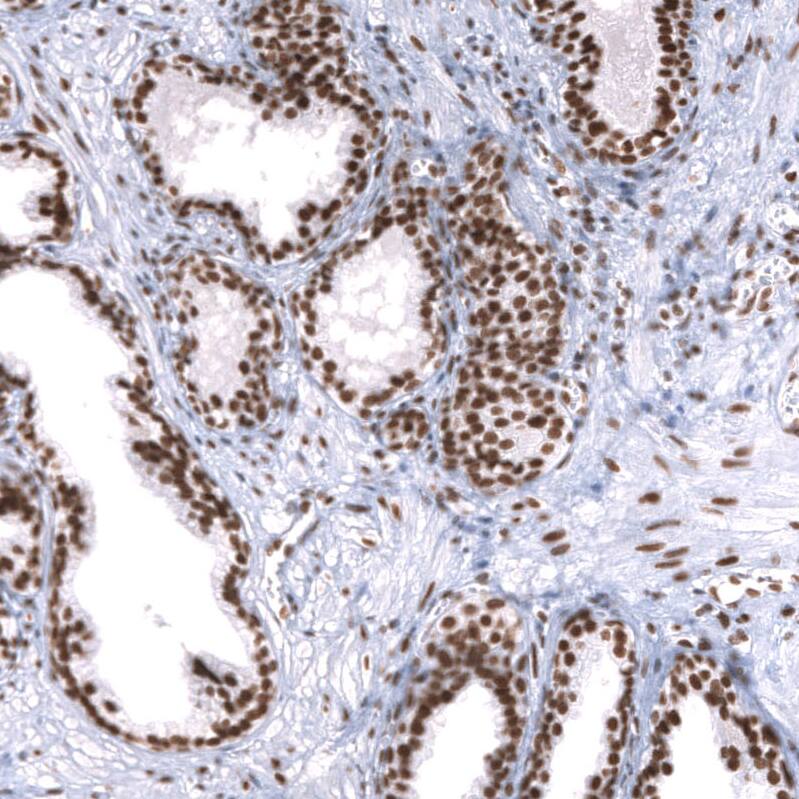 SNF5 Antibody (CL14031) - Azide and BSA Free Immunohistochemistry-Paraffin: SNF5 Antibody [NBP3-43864]