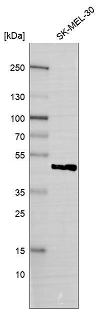 SNF5 Antibody (CL14031) - Azide and BSA Free Western Blot: SNF5 Antibody [NBP3-43864]
