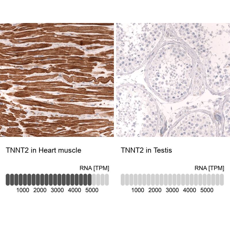 Troponin T Type 2 (cardiac) Antibody (CL13382) - Azide and BSA Free Immunohistochemistry-Paraffin: Troponin T Type 2 (cardiac) Antibody [NBP3-43865]