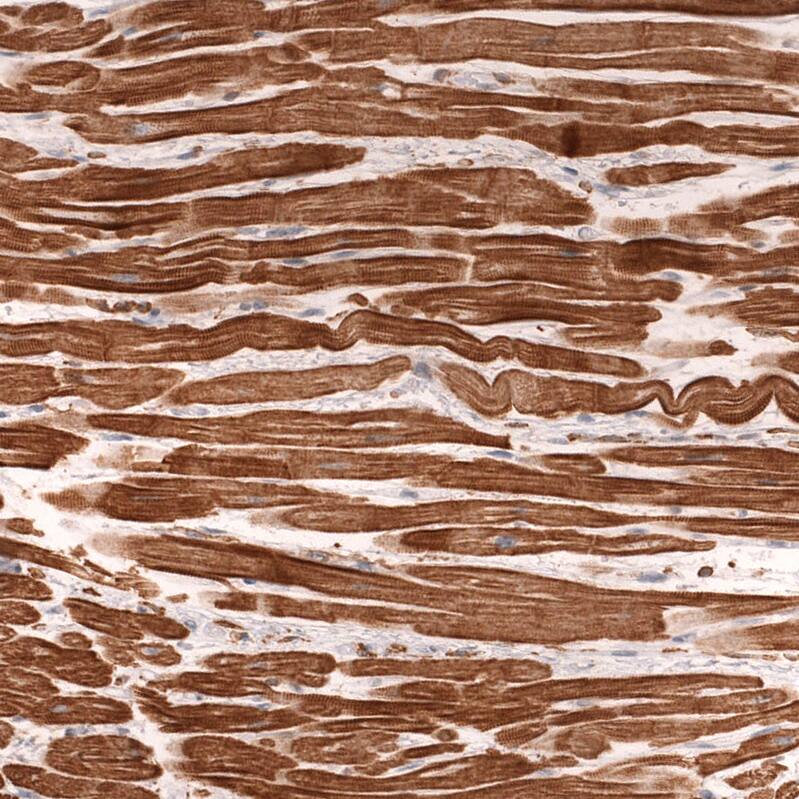 Troponin T Type 2 (cardiac) Antibody (CL13382) - Azide and BSA Free Immunohistochemistry-Paraffin: Troponin T Type 2 (cardiac) Antibody [NBP3-43865]