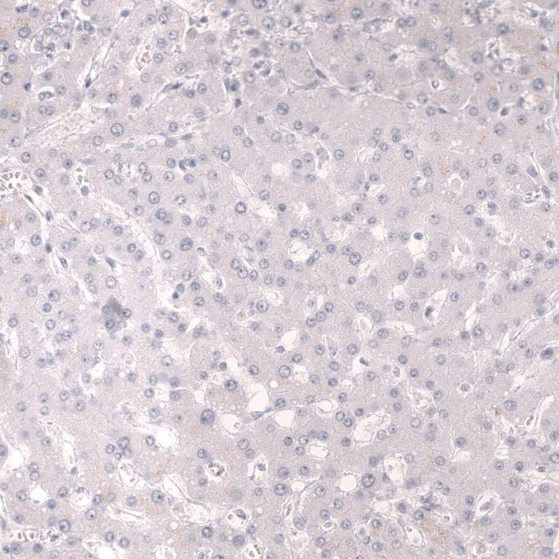 Troponin T Type 2 (cardiac) Antibody (CL13382) - Azide and BSA Free Immunohistochemistry-Paraffin: Troponin T Type 2 (cardiac) Antibody [NBP3-43865]