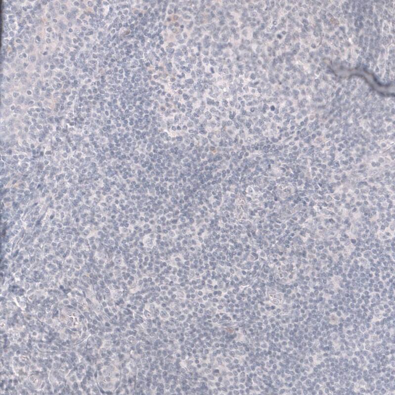 Troponin T Type 2 (cardiac) Antibody (CL13403) - Azide and BSA Free Immunohistochemistry-Paraffin: Troponin T Type 2 (cardiac) Antibody [NBP3-43866]