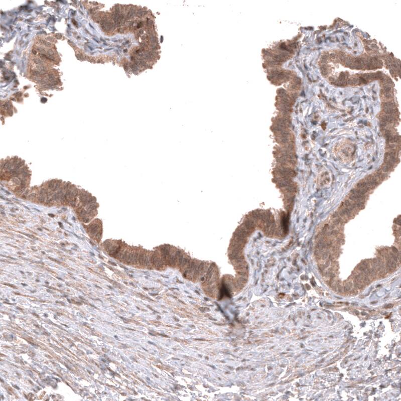 Wnt-5a Antibody (CL13683) - Azide and BSA Free Immunohistochemistry-Paraffin: Wnt-5a Antibody [NBP3-43867]