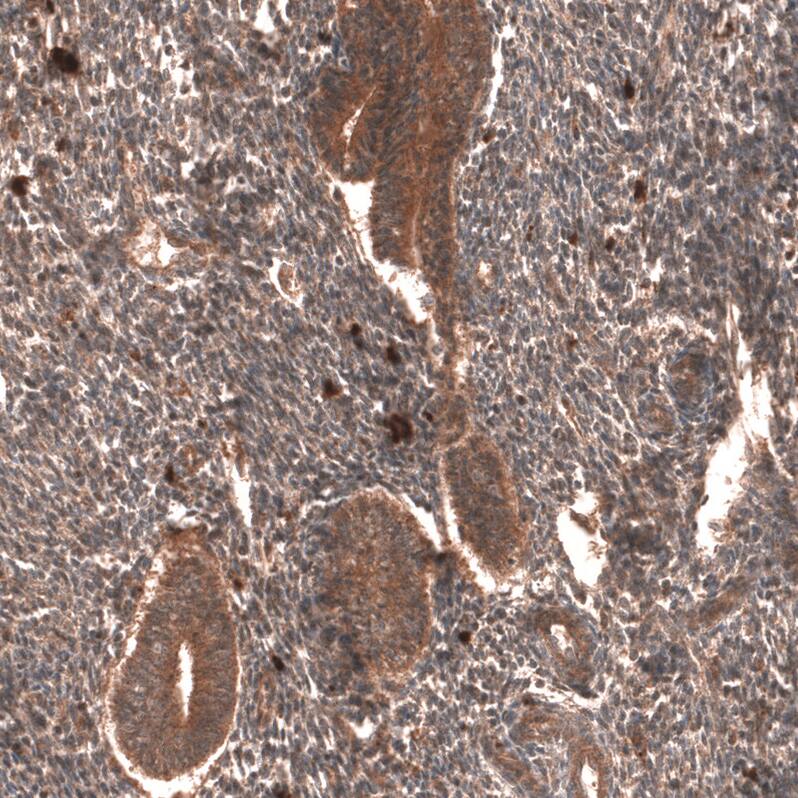 YAP1 Antibody (CL13628) - Azide and BSA Free Immunohistochemistry-Paraffin: YAP1 Antibody [NBP3-43868]