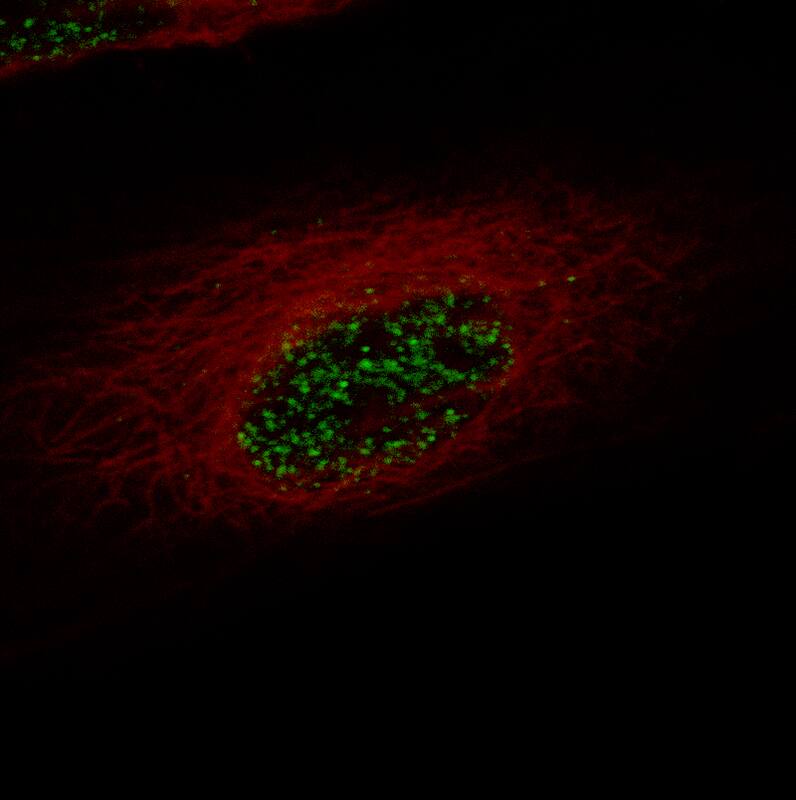 ZEB2 Antibody (CL13467) - Azide and BSA Free Immunocytochemistry/ Immunofluorescence: ZEB2 Antibody [NBP3-43869]