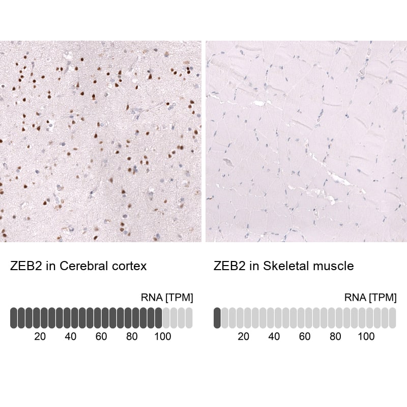 ZEB2 Antibody (CL13467) - Azide and BSA Free Immunohistochemistry-Paraffin: ZEB2 Antibody [NBP3-43869]