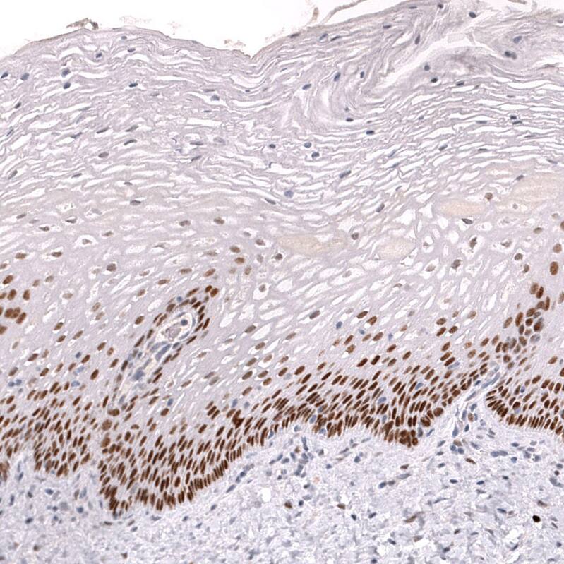 ZEB2 Antibody (CL13467) - Azide and BSA Free Immunohistochemistry-Paraffin: ZEB2 Antibody [NBP3-43869]